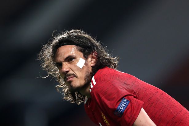 Edison Cavani Dengan Kabar Proses Penyembuhan Cedera